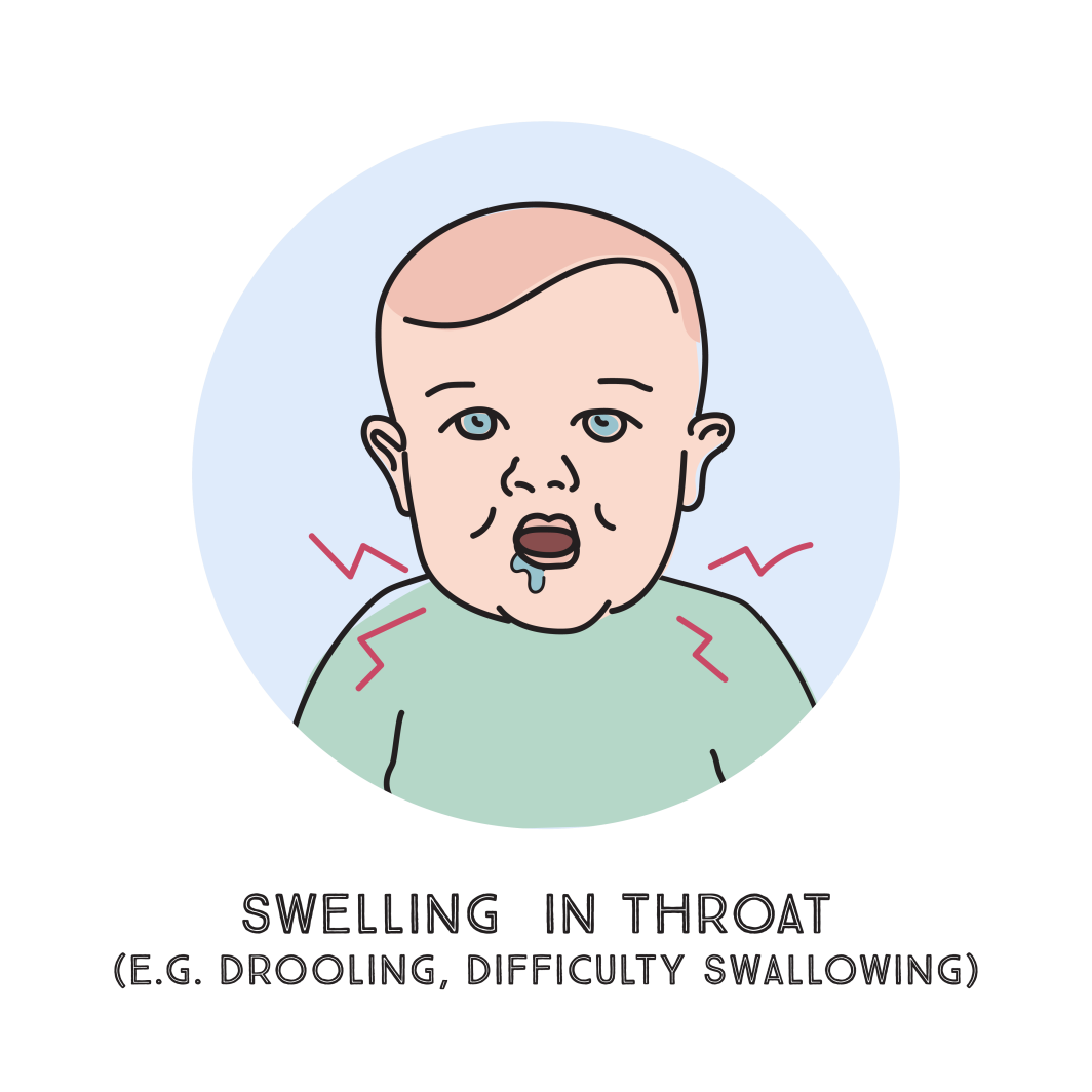 How to recognise an allergic reaction Prevent Allergies